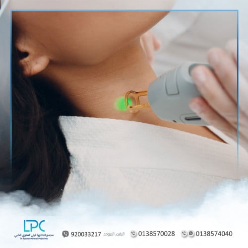 ليزر منطقة الوجه و الرقبة (السيدات أو الرجال)