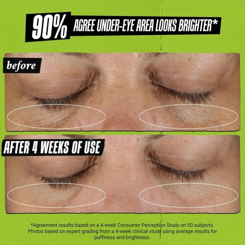 كيلز كريم العين بالأفوكادو لعلاج الهالات السوداء و...