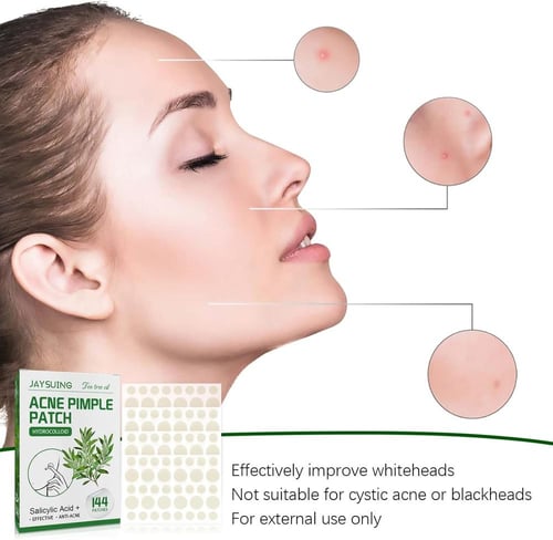 لاصقات لعلاج حب الشباب – 144 قطعة بخلاصة زيت شجرة...