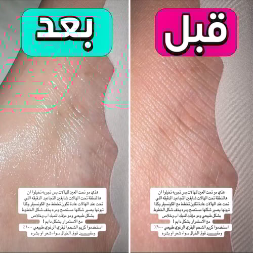 كريم الشحم البقري لاثار الجروح والتسرتش مارك