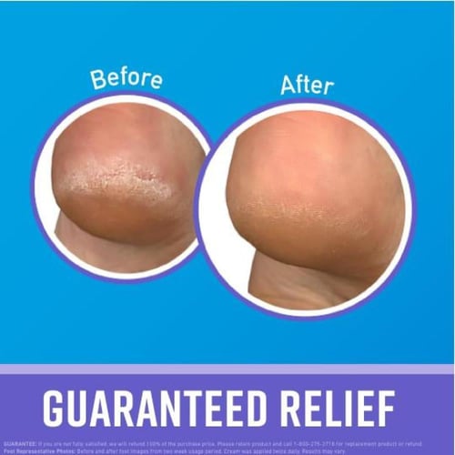 كريم الترطيب المكثف طوال الليل للأقدام من اوكيفز ،...