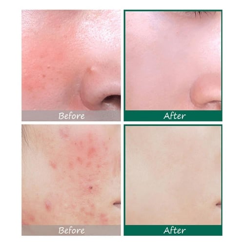 سيروم العناية AHA BHA PHA من سوم باي مي - 50مل