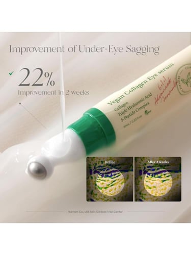 سيروم العين بالكولاجين النباتي من اكسيس واي , 10مل