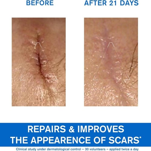 كريم يورياج مرطب مرمم ومهدئ باريديرم سيكا مع النحا...