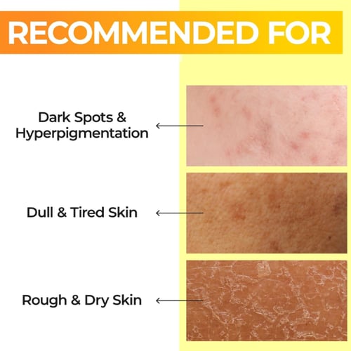 تونر نومبوزين رقم 5 المعزز بالفيتامينات – 200 مل