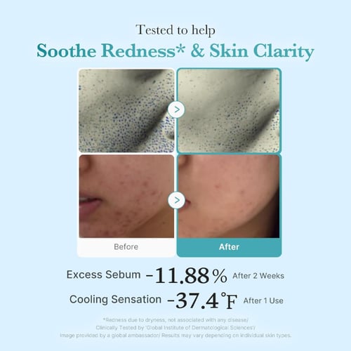 تونر ميديكيوب بالأزليك أسيد والنياسيناميد لتنقية و...