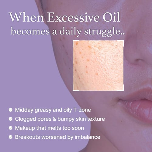 تونر بخلاصة الأرز الأسود من آيم فروم – 150 مل