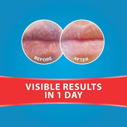 مرطب الشفاه فائق الترطيب من فليكسيتول - 10 جم