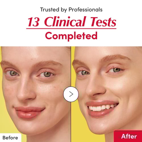 ايكوال بيري سيروم بفيتامين سي لتفتيح وتوحيد لون ال...