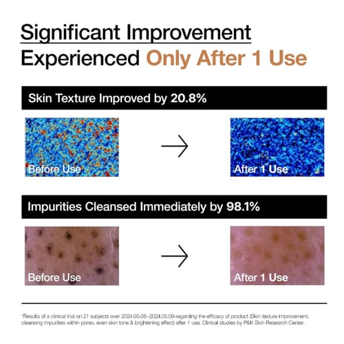 أنوا بودرة منظفة ومفتحة للوجه بأنزيمات الأرز - 40...