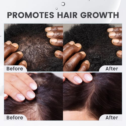 سيروم سيبوري لانبات الفراغات ومنع تساقط الشعر – 20...