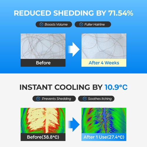 سيروم سيبوري لانبات الفراغات ومنع تساقط الشعر – 20...