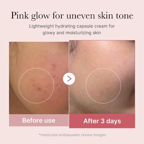 كريم الكبسولات الوردية بالكولاجين والسلمون من ميدي...