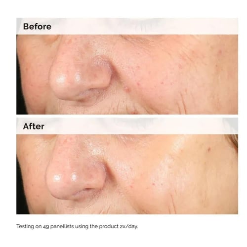 سيروم ألفا أربوتين 2% مع حمض الهيالورونيك لتفتيح ا...