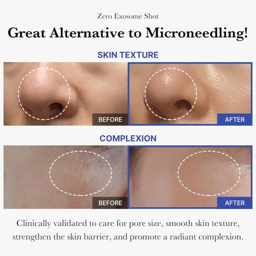 ميديكيوب امبولة الوجه إكسوسوم شوت 7500 – معزز للبش...