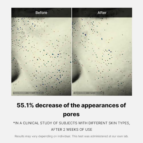 كريم زيرو بور ون داي من ميديكيوب لتنقية المسام 50...