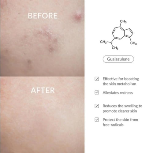 كريم 147 باريير ترطيب عميق لحاجز البشرة من دكتور ا...