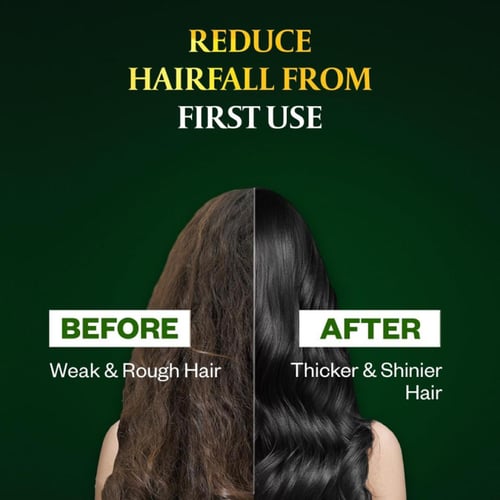 زيت جوز الهند للشعر غني بفيتامين E من باراشوت – 30...