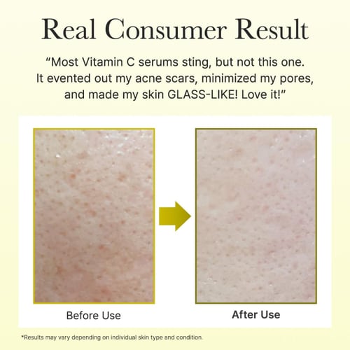 كريم تعزيز فيتامين سي لتفتيح وإشراقة البشرة من اري...