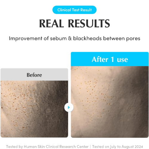 وسائد تونر لتقشير وترطيب البشرة من إيكوال بيري – 7...