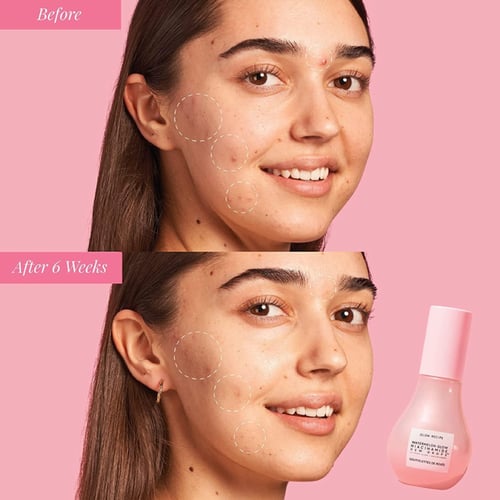 جلو ريسيبي سيروم ترطيب للوجه ومعالج التصبغات بالبط...