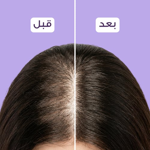 جروفا زيت لتنبيت الشعر 120 مل