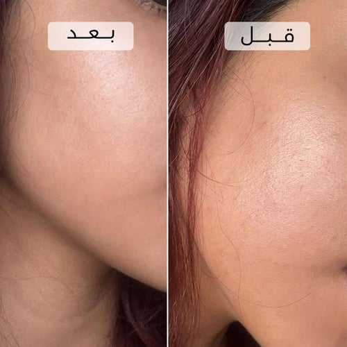 باقة سيروم و لوشن تفتيح الوجه والجسم