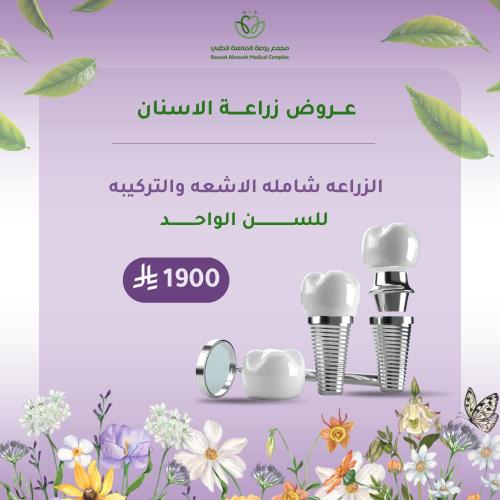 زرعة اسنان شاملة الاشعة والتركيبة ( سن واحد)