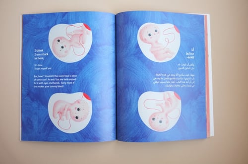 أصغر من حبة بازلاء