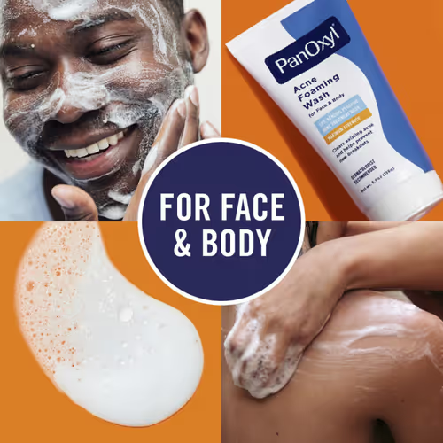 غسول كريمي لحب الشباب بنزويل بيروكسيد 4% من بانوكس...