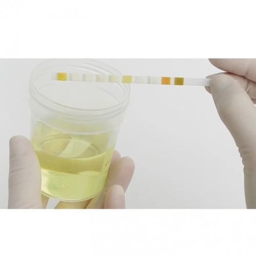 شرائط فحص البول كمبر تن