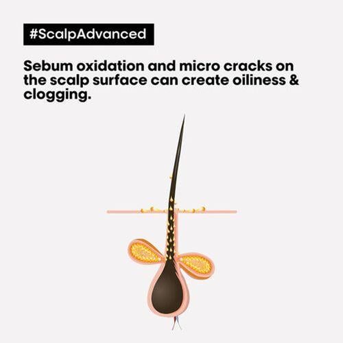 لوريال بروفيشنال منظف عميق سكالب ادفانسد لفروه الر...