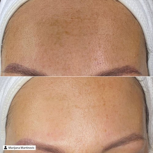 Derma SR Anti-Pigment Exfoliator