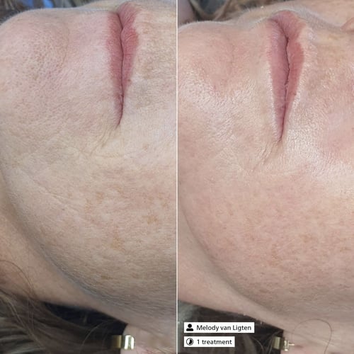 Derma SR Anti-Aging Serum