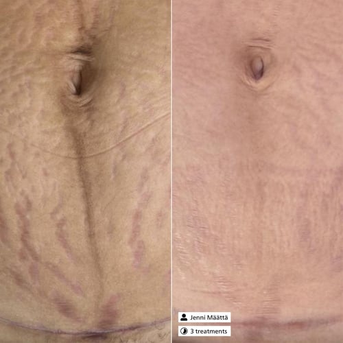 Derma SR Scar Relaxing Serum