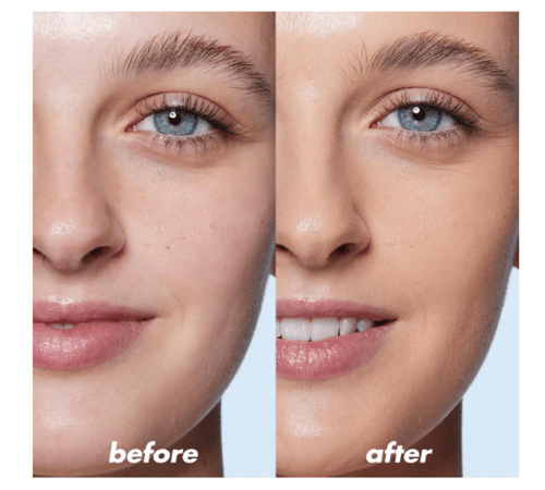 مصحح ايلف - الاخضر