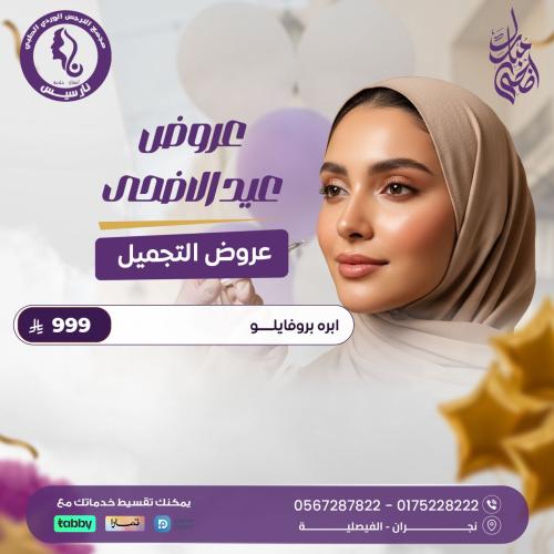ابرة بروفايلو