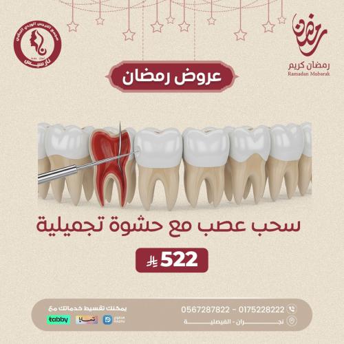 سحب عصب مع حشوة تجميلية