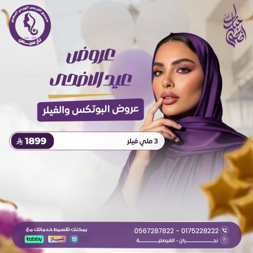 3 ملي فيلر