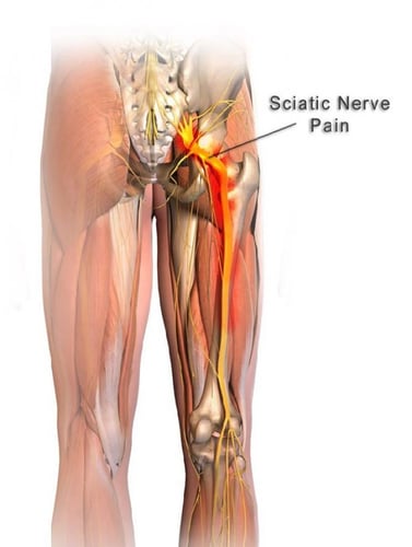 حزام مساج الظهر والخصر CSD747