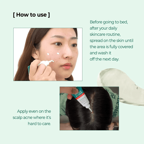 كريم المعجزة اي سي كلير سبوت تريتمنت من سوم باي مي...