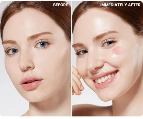 ميديكيوب كريم جل بالكولاجين - 110 مل