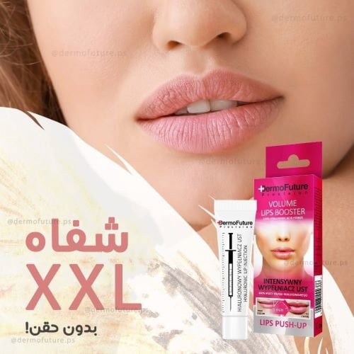 فيلر تعزيز الشفاه من ديرموفيوتشر