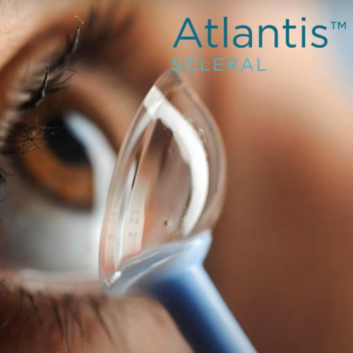 عدسات صلبة اتلانتس | ATLANTIS SCLERAL LENS