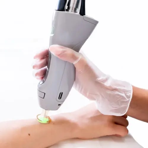 جلسة ليزر للنساء لأي منطقة من اختيارك