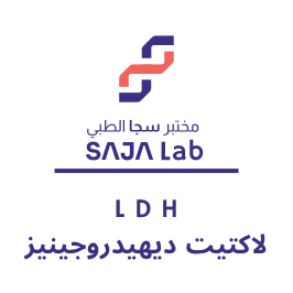 لاكتيت ديهيدروجينيز