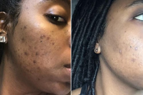 صابونة الكركم والكوجيك أسيد التايلندية (حبتين )