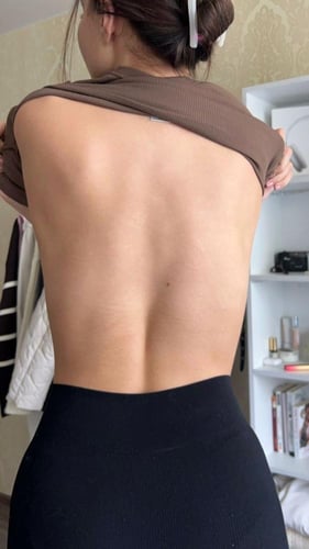 مجموعة الكوجيك أسيد لتفتيح لون الجسم و توحيد لونه