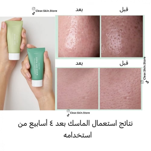 أكسيس Axis-مجموعة ماسك 2في 1 لتنظيف المسام و نضارة...