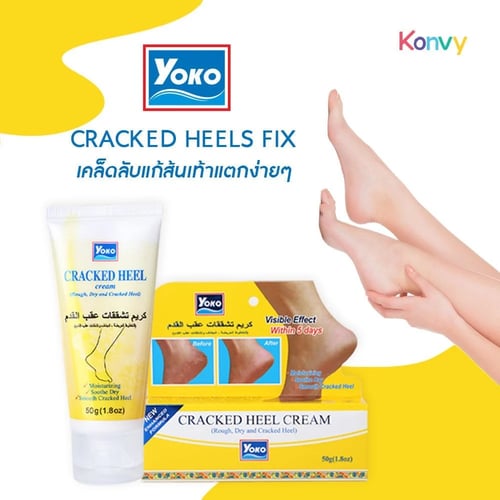 كريم تشققات كعب القدم من يوكو - 50 جرام